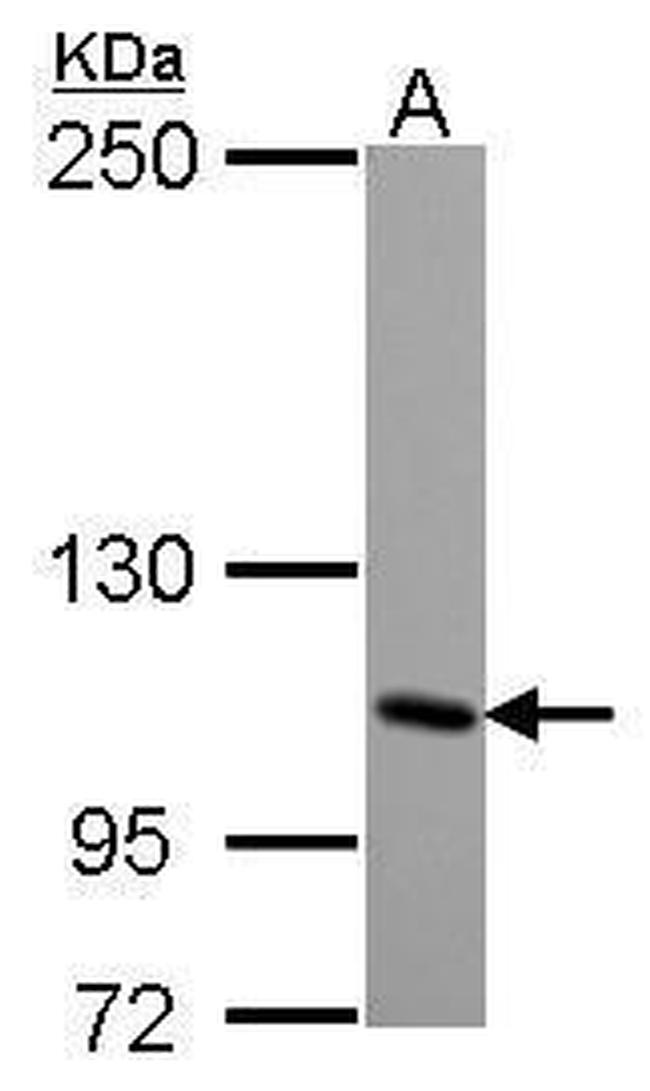 GRIK4 Antibody in Western Blot (WB)