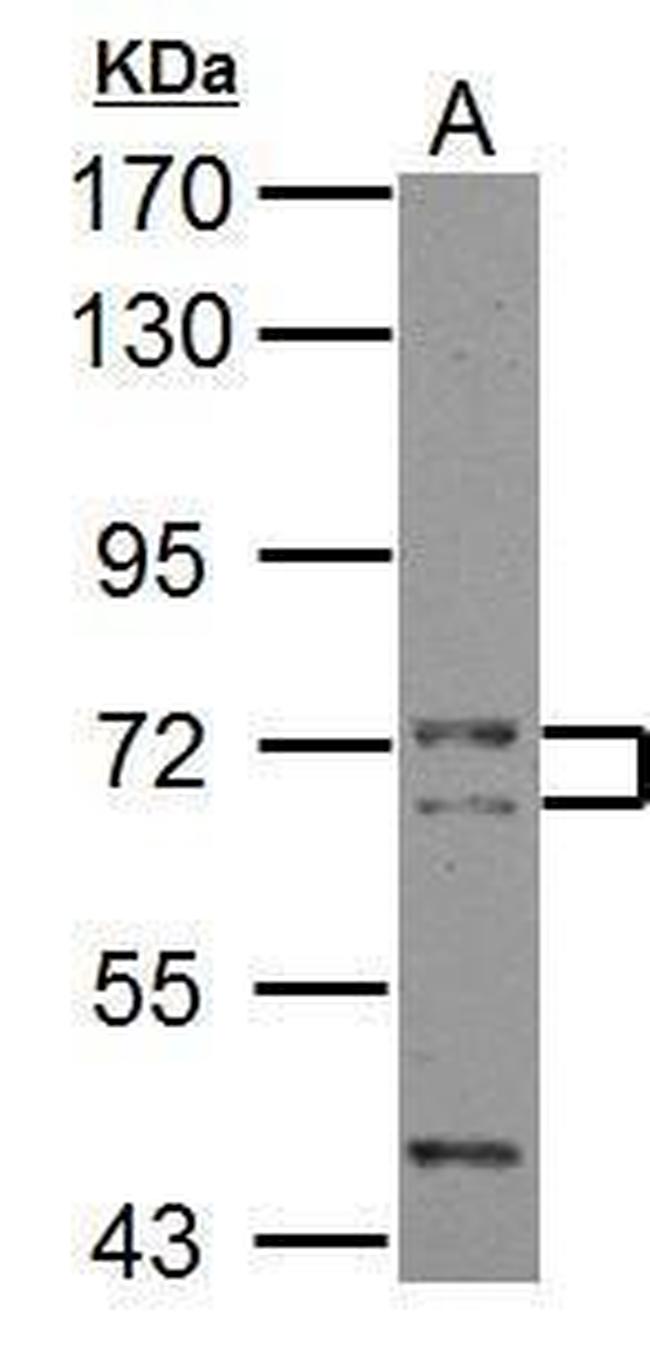 CALM Antibody in Western Blot (WB)