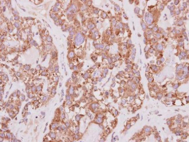 PCYOX1 Antibody in Immunohistochemistry (Paraffin) (IHC (P))