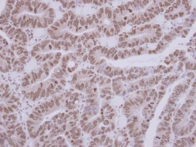 ASC1 Antibody in Immunohistochemistry (Paraffin) (IHC (P))