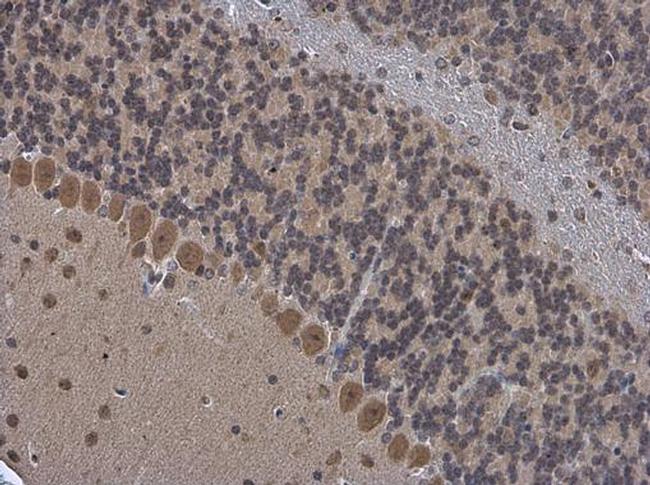 OGFOD1 Antibody in Immunohistochemistry (Paraffin) (IHC (P))