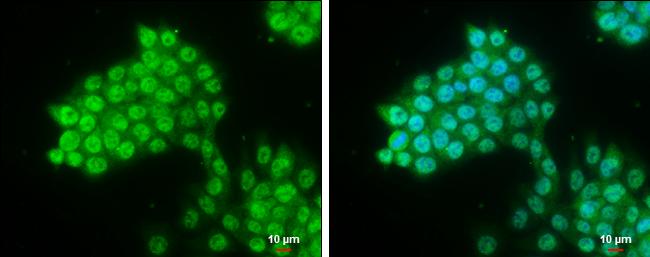 PYGO2 Antibody in Immunocytochemistry (ICC/IF)