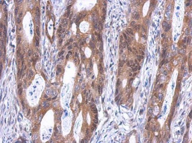 GINS4 Antibody in Immunohistochemistry (Paraffin) (IHC (P))