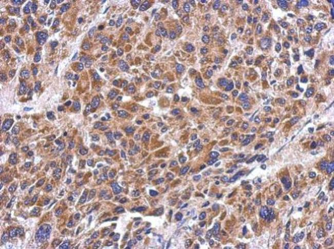 MRPS26 Antibody in Immunohistochemistry (Paraffin) (IHC (P))