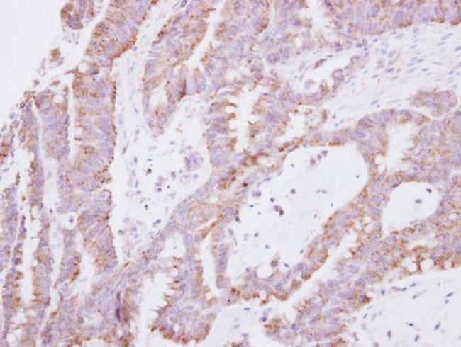 EAP30 Antibody in Immunohistochemistry (Paraffin) (IHC (P))