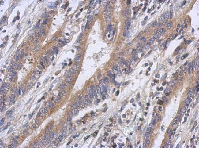 FBXW5 Antibody in Immunohistochemistry (Paraffin) (IHC (P))