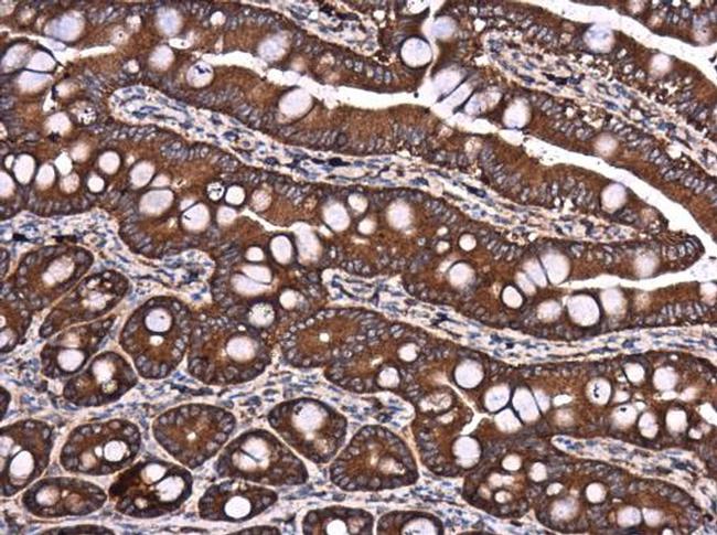 DYNC1LI1 Antibody in Immunohistochemistry (Paraffin) (IHC (P))