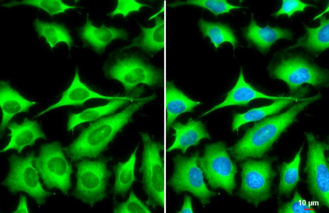 ZC3HAV1 Antibody in Immunocytochemistry (ICC/IF)