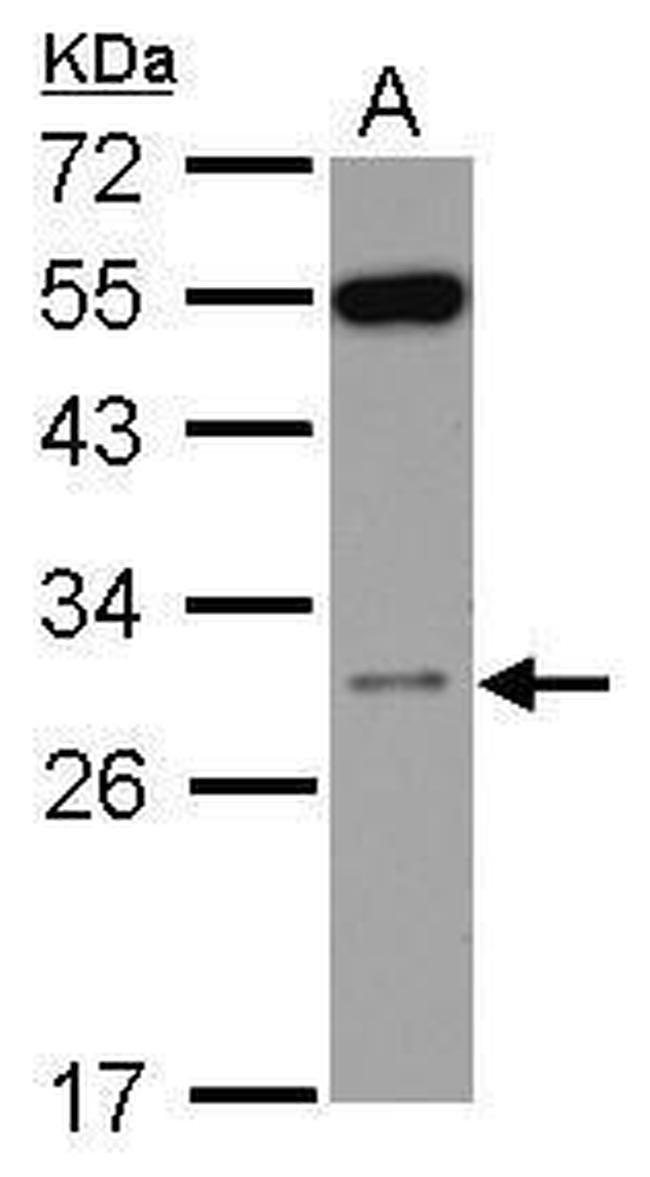 RPS8 Antibody in Western Blot (WB)