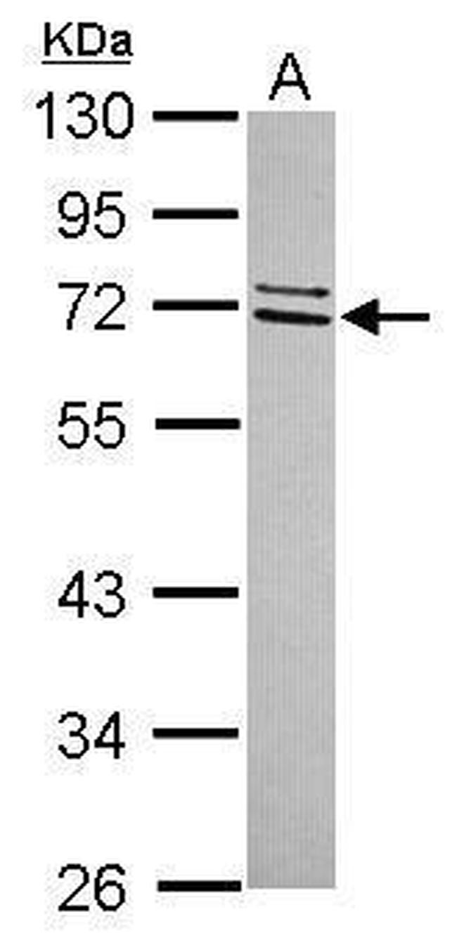 CCDC67 Antibody in Western Blot (WB)