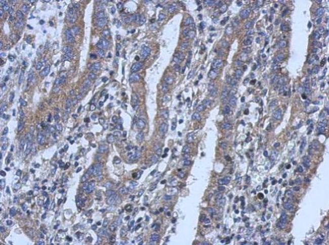 LYPLA3 Antibody in Immunohistochemistry (Paraffin) (IHC (P))