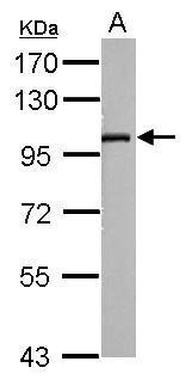 SLC9A8 Antibody in Western Blot (WB)