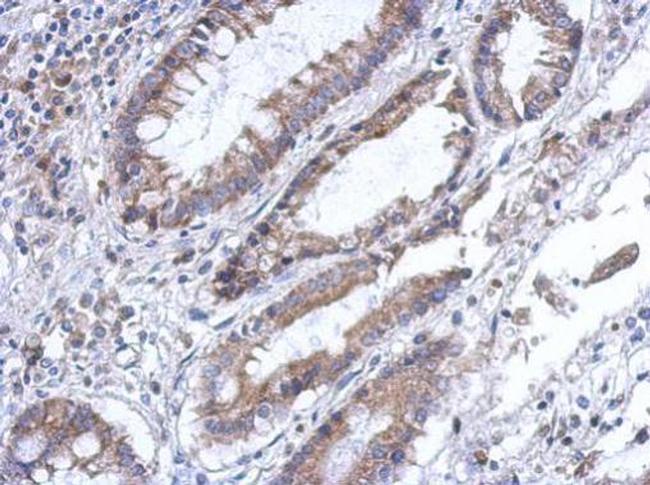 PLA2G4F Antibody in Immunohistochemistry (Paraffin) (IHC (P))