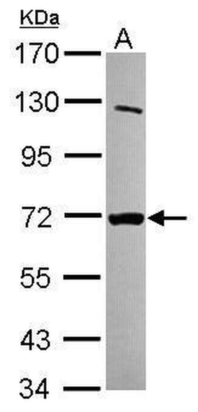 MTMR8 Antibody in Western Blot (WB)