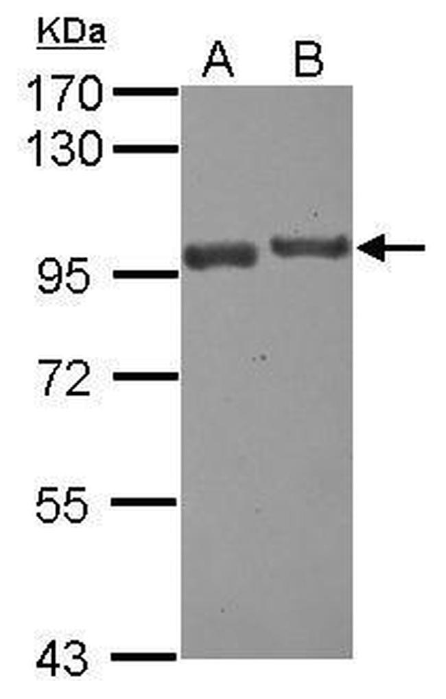 USP6NL Antibody in Western Blot (WB)