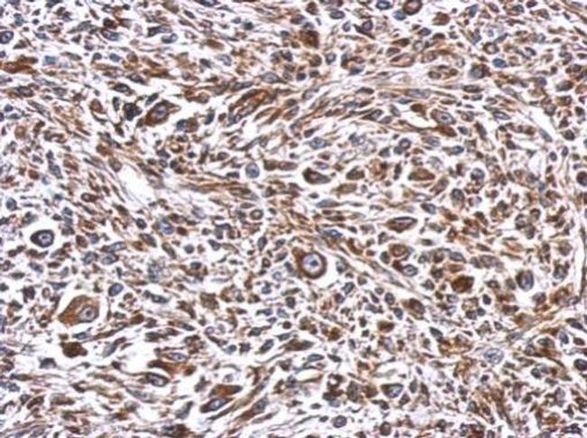 ERLIN1 Antibody in Immunohistochemistry (Paraffin) (IHC (P))