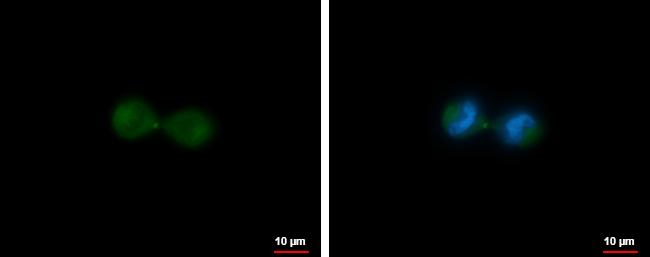 KIF23 Antibody in Immunocytochemistry (ICC/IF)