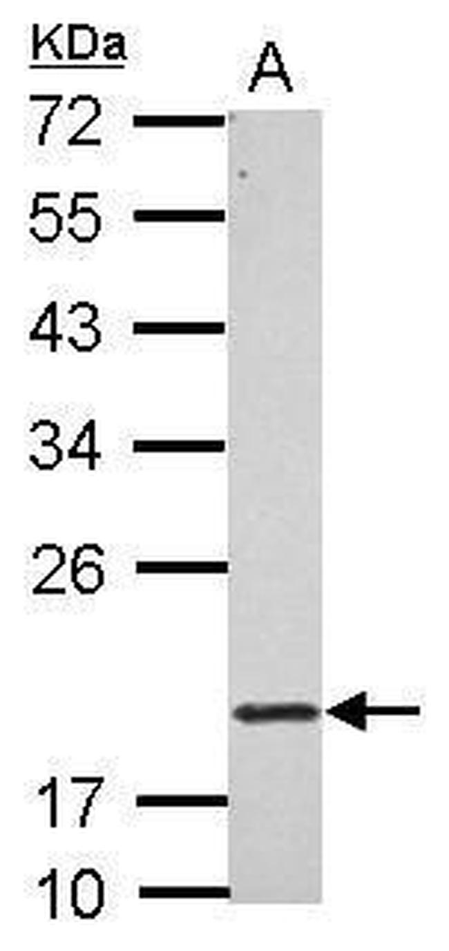 RNF5 Antibody in Western Blot (WB)