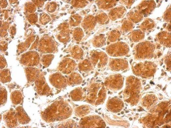 SEMA4B Antibody in Immunohistochemistry (Paraffin) (IHC (P))