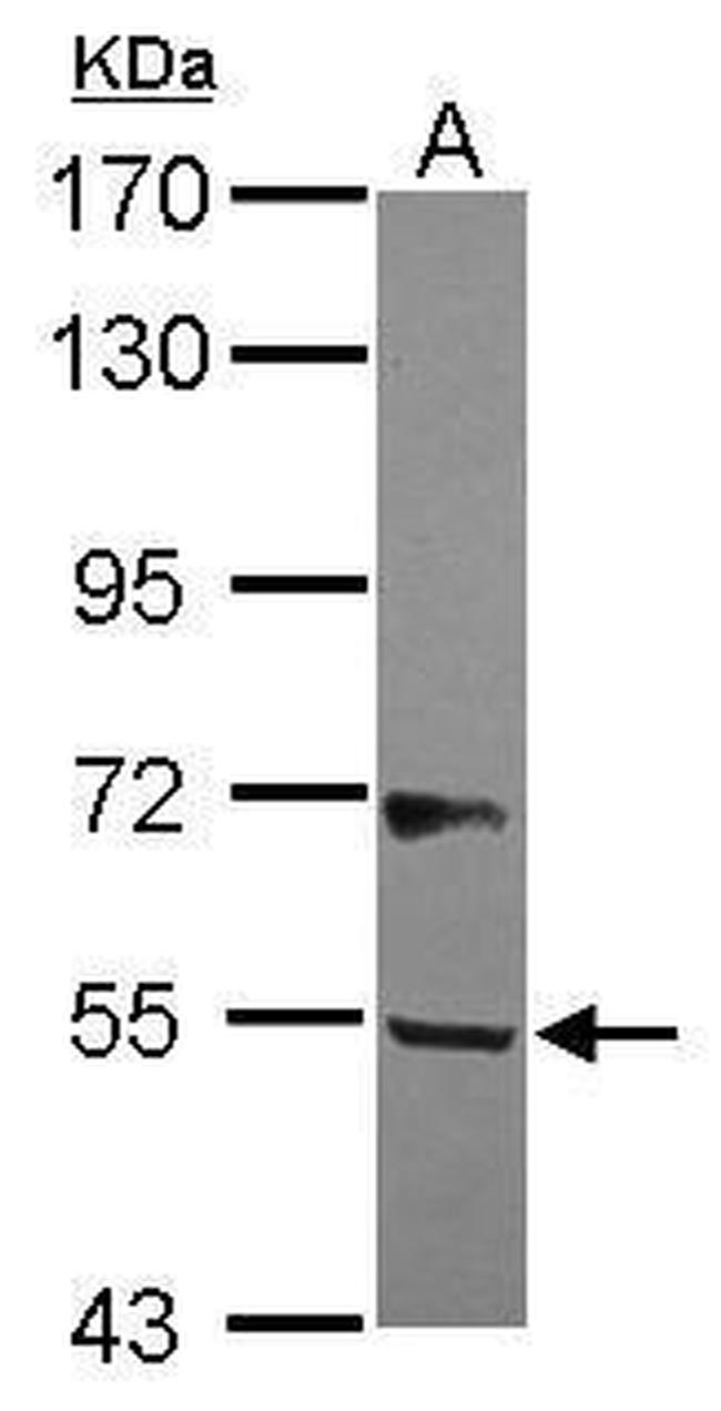 B3GALNT2 Antibody in Western Blot (WB)