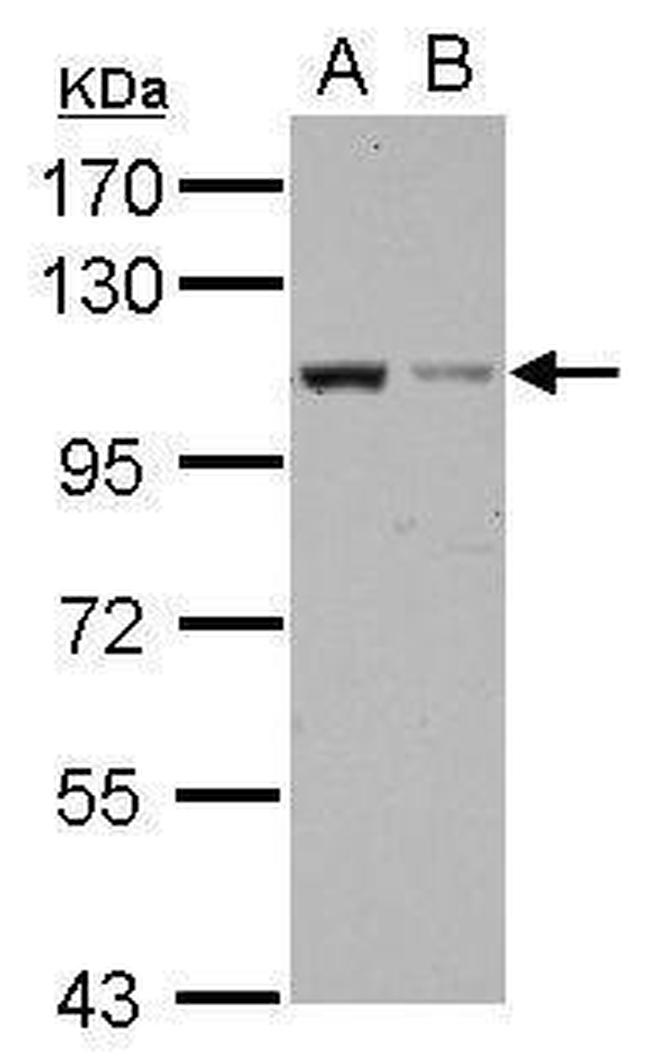 EXOC2 Antibody in Western Blot (WB)