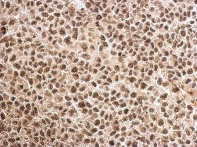 MAGEB18 Antibody in Immunohistochemistry (Paraffin) (IHC (P))