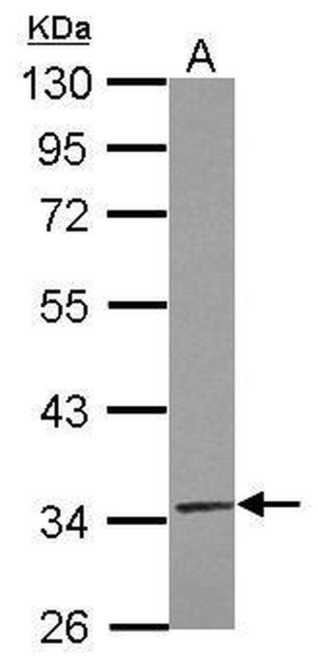 TRUB2 Antibody in Western Blot (WB)