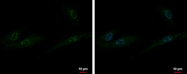 ZXDA Antibody in Immunocytochemistry (ICC/IF)