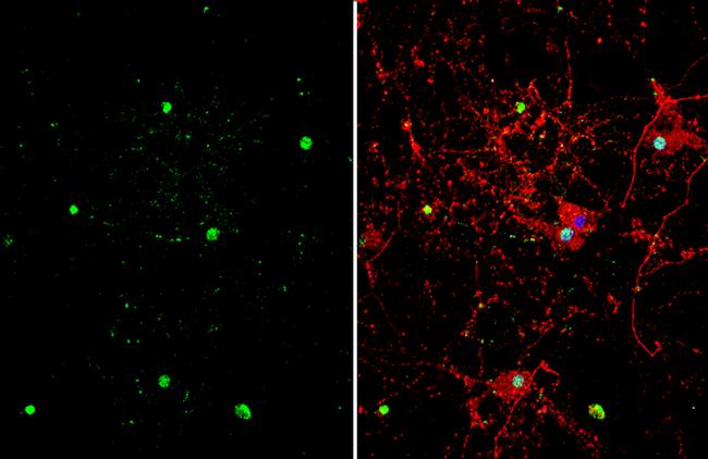 ZBTB20 Antibody in Immunocytochemistry (ICC/IF)