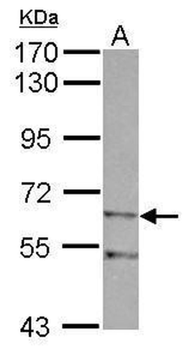 ZIM2 Antibody in Western Blot (WB)