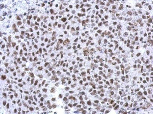 Histone H1.4 Antibody in Immunohistochemistry (Paraffin) (IHC (P))