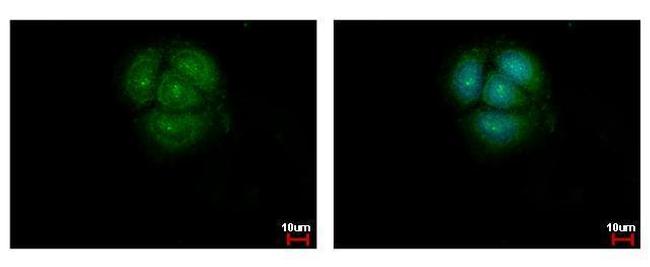 AKT Pan Antibody in Immunocytochemistry (ICC/IF)