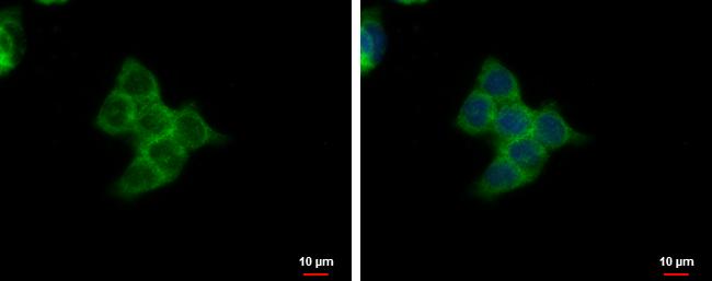 SMYD3 Antibody in Immunocytochemistry (ICC/IF)