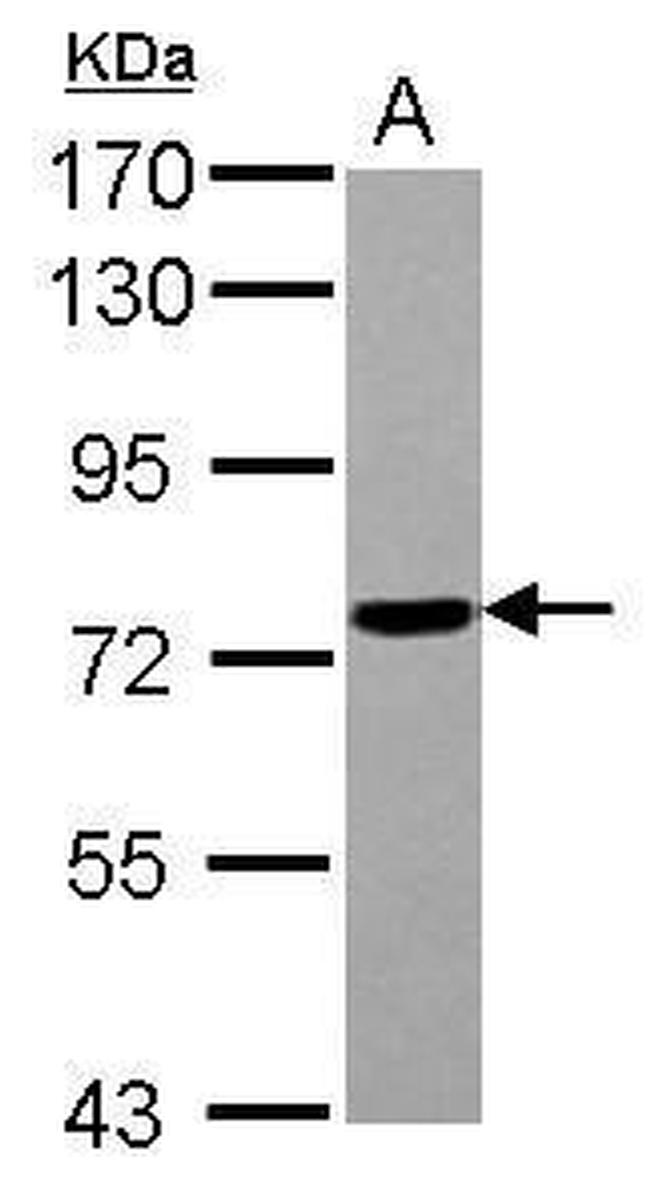 POLR3E Antibody in Western Blot (WB)