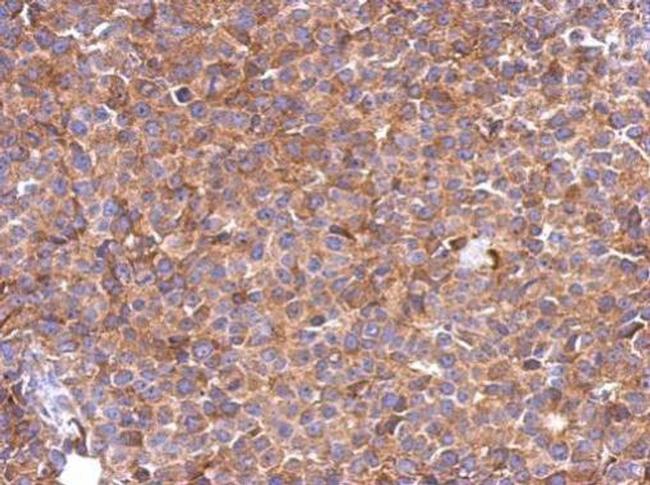 SLC25A46 Antibody in Immunohistochemistry (Paraffin) (IHC (P))