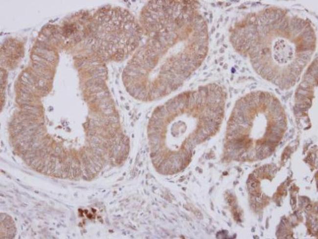 CPEB1 Antibody in Immunohistochemistry (Paraffin) (IHC (P))