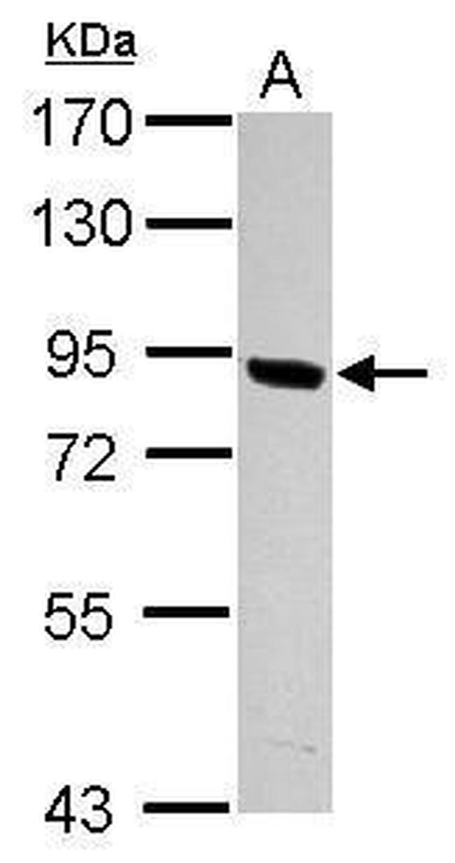 PNPLA8 Antibody in Western Blot (WB)