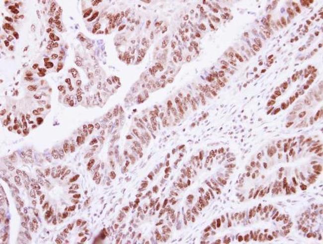 Histone H1.2 Antibody in Immunohistochemistry (Paraffin) (IHC (P))