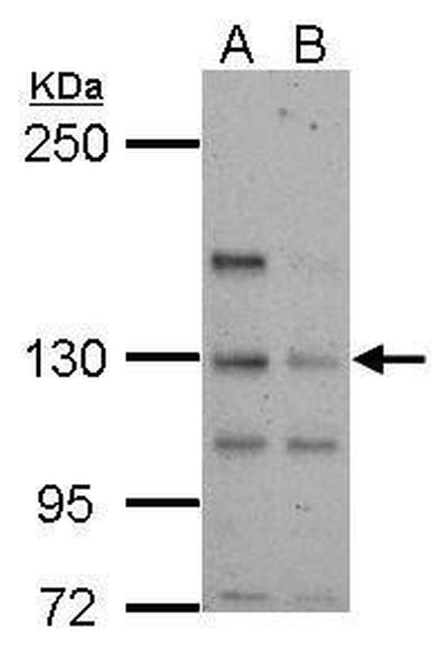 TTLL4 Antibody in Western Blot (WB)