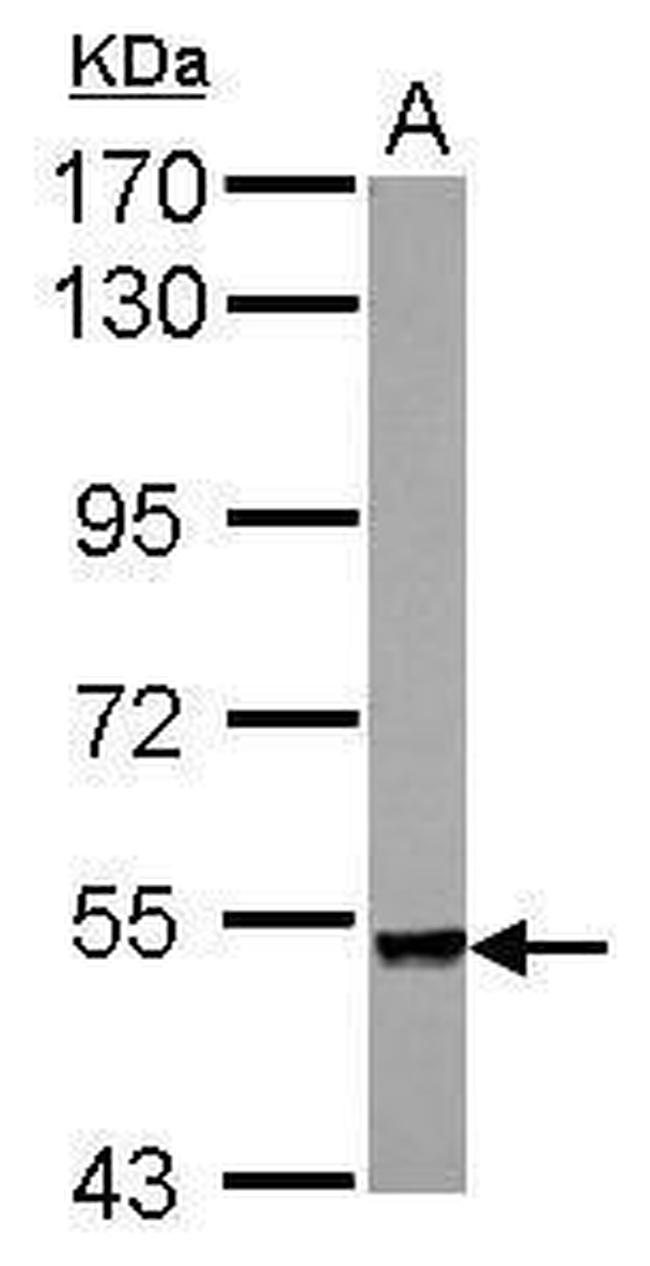 PLXNA4 Antibody in Western Blot (WB)