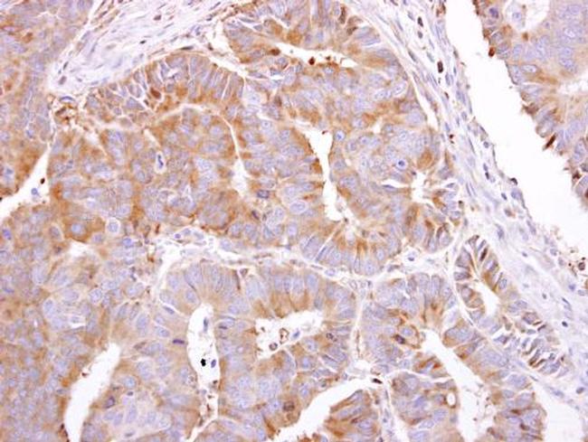 PEPP2 Antibody in Immunohistochemistry (Paraffin) (IHC (P))