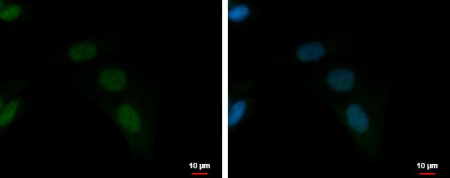 ZFAT Antibody in Immunocytochemistry (ICC/IF)