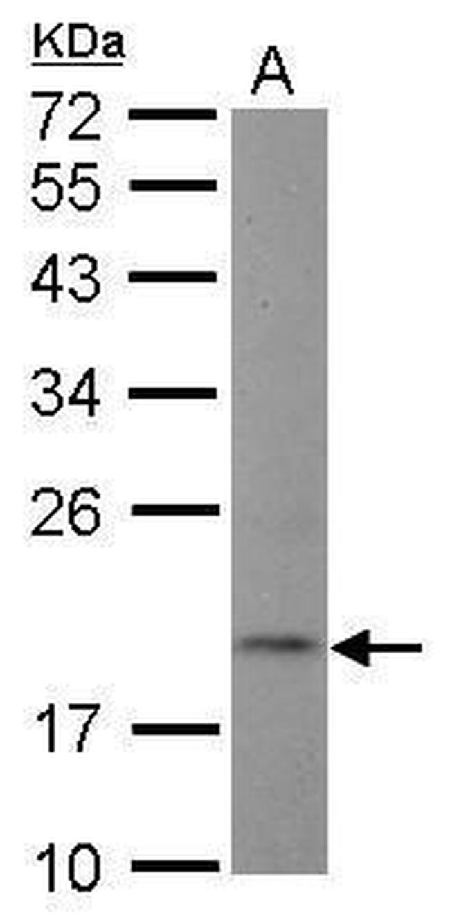 NT5C Antibody in Western Blot (WB)