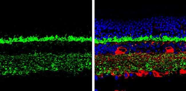 CPLX3 Antibody in Immunohistochemistry (Paraffin) (IHC (P))