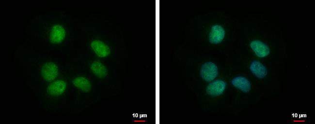 RBMY1F Antibody in Immunocytochemistry (ICC/IF)