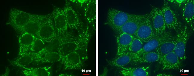 DHRS2 Antibody in Immunocytochemistry (ICC/IF)