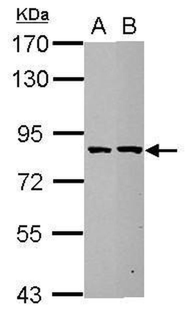 ESRP2 Antibody in Western Blot (WB)