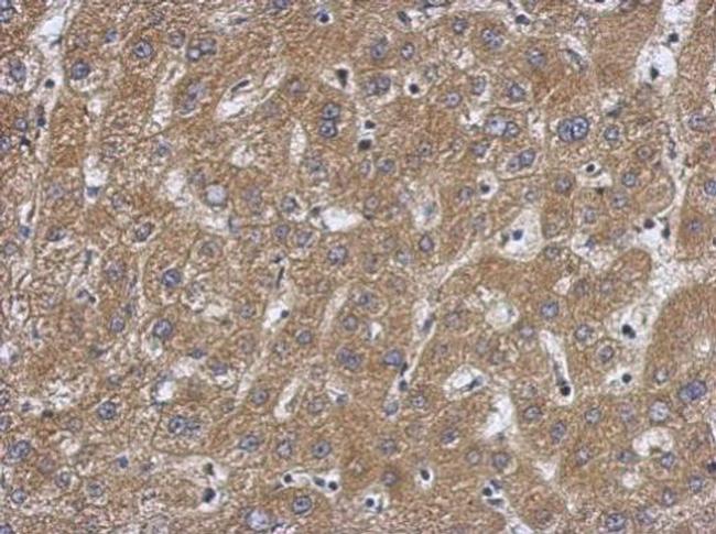 Caspase 7 p11 Antibody in Immunohistochemistry (Paraffin) (IHC (P))