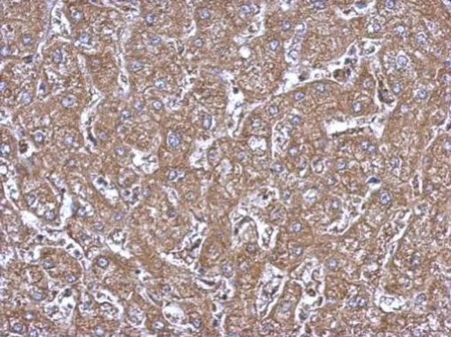 ALDH1A1 Antibody in Immunohistochemistry (Paraffin) (IHC (P))