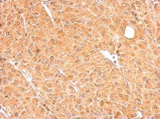 GALM Antibody in Immunohistochemistry (Paraffin) (IHC (P))